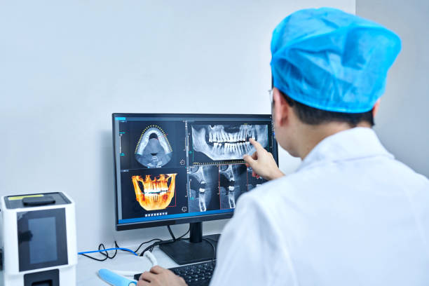 Best Emergency Wisdom Teeth Removal in Marion, IN
